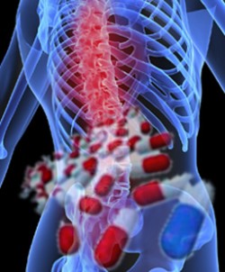 osteoporoza-01.jpg osteoporoza-01.jpg