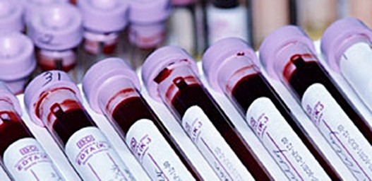Preventivni pregledi najbolja terapija 