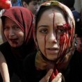 Цивили, намерне жртве рата у Сирији