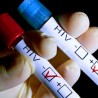 Лечење ХИВ-а у Србији застарело, али ефикасно