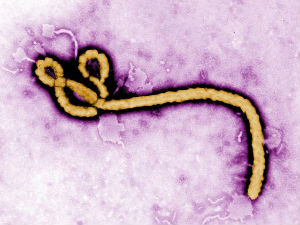 Италија, медицинска сестра оболела од еболе