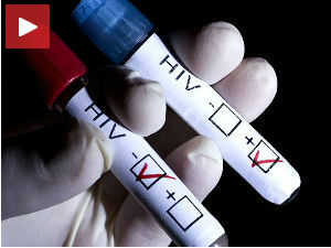 Сваки трећи заражени не зна да има ХИВ