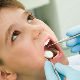 Све више деце са аномалијама зуба