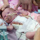 Доктори „чудотворци“, беба са срцем ван тела сада мирно спава