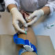 Медицина на корак од крвног теста за откривање рака!