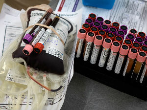 Нова метода тестирања крви која се уводи у Србији брже открива вирус