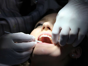 Половина Србије не пере зубе, више од девет одсто нема ниједан зуб