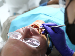 Чак 700.000 људи у Србији нема ниједан зуб – хоће ли стоматолошке услуге поново бити бесплатне