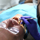 Чак 700.000 људи у Србији нема ниједан зуб – хоће ли стоматолошке услуге поново бити бесплатне