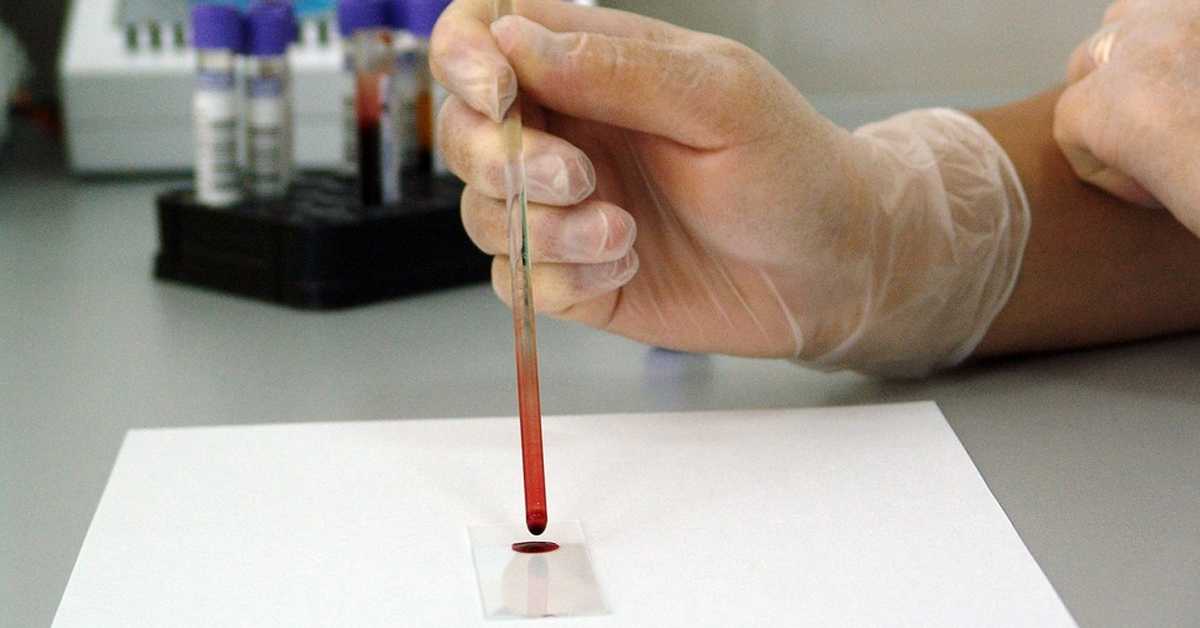 Научници развили тест из крви за мерење степена анксиозности
