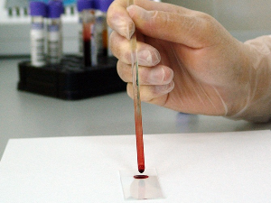 Научници развили тест из крви за мерење степена анксиозности