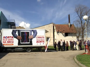 Мобилна ординација - почиње организовани скрининг анеуризме трбушне аорте