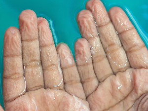 То што нам се прсти наборају у води даје нам изненађујуће предности