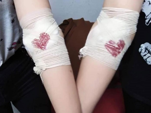 На Светски дан давалаца крви резерве у Србији су стабилне, али не сме бити опуштања пред лето