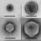 Новооткривени џиновски вируси изгледају као звезде, корњаче и бочице парфема