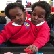 Сијамске близнакиње славе седми рођендан - прогнозирали су им само неколико дана живота 