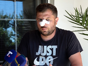 Србин нападнут у Доњој Брњици, нанете му повреде у пределу главе