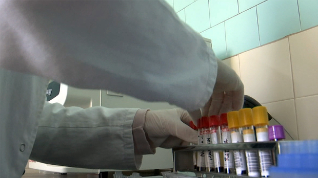 Губа стигла у регион, епидемиолози: У Србији нема разлога за забринутост