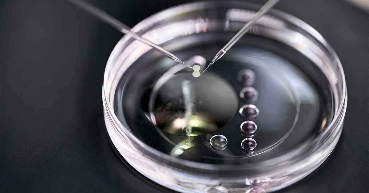 Да ли полигенски скрининг ембриона омогућава родитељима да имају паметнију и здравију децу