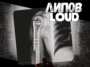  Липов Loud