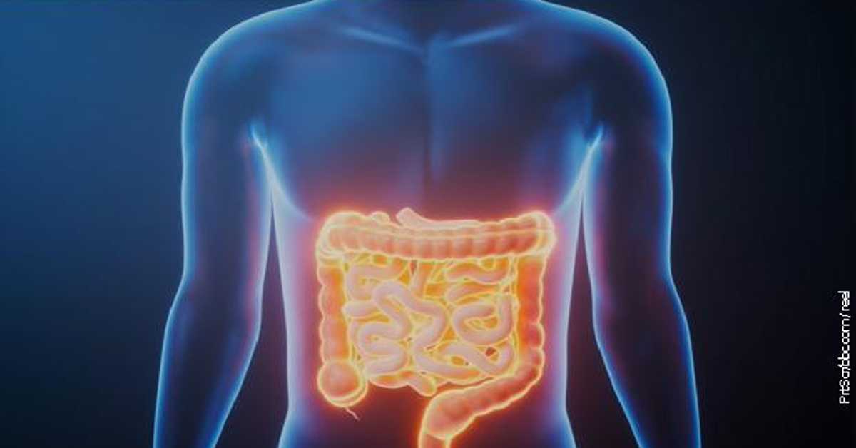 Узорци тумора стари више од једног века могли би да открију узроке повећања броја рака црева код младих 