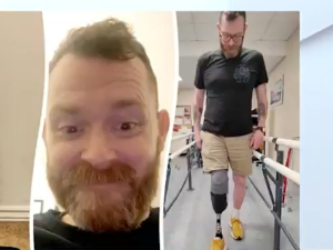 Направио протезу за ногу од делова са интернета и уштедео десетине хиљаде евра