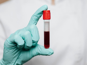 Једна крвна група изгледа да носи већи ризик од дијабетеса типа 2