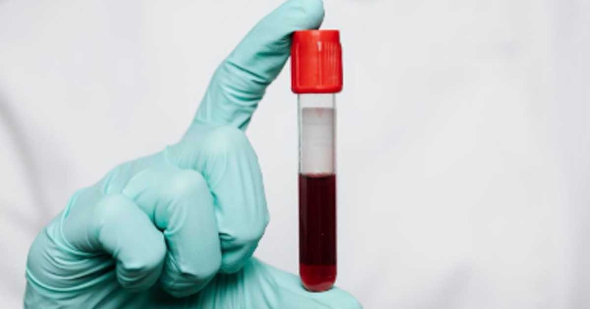 Једна крвна група изгледа да носи већи ризик од дијабетеса типа 2