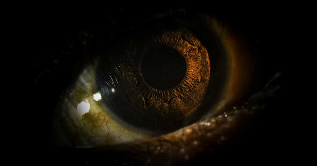 Људи ипак имају треће око које су користили наши преци, знате ли где се налази