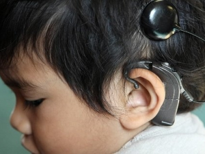 Кинески стручњаци генском терапијом вратили слух код 90 одсто деце са наследном глувоћом
