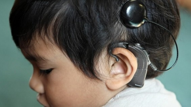 Кинески стручњаци генском терапијом вратили слух код 90 одсто деце са наследном глувоћом