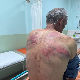 Српска листа: Припадници косовске полиције претукли Ненада Рашковића код Зубиног Потока