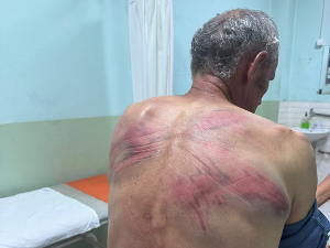 Српска листа: Припадници косовске полиције претукли Ненада Рашковића код Зубиног Потока