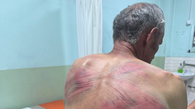 Српска листа: Припадници косовске полиције претукли Ненада Рашковића код Зубиног Потока