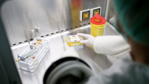 Велики корак за „Торлак“ – најбољи резултати у програму СЗО за mRNA технологију