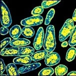 tuberkuloza2.jpg tuberkuloza2.jpg