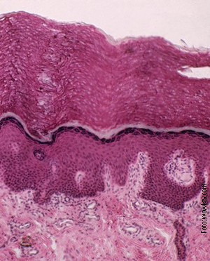 Intersticijum je sloj u ljudskim tkivima ispunjen tečnošću, a na ovoj slici, koja predstavlja kožu, obeležen je roze bojom