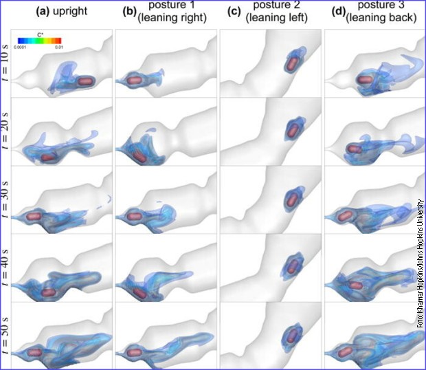 Kompjuterski model apsorpcije leka u zavisnosti od položaja tela
