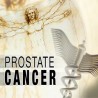 Нове методе у лечењу рака простате 