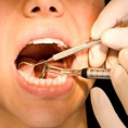 Ум страда због болесних зуба