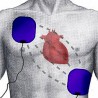 Дефибрилатор с поткожним електродама