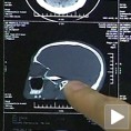 Спасла га је „тврдоглавост“