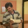 Нападнут радник електродистрибуције