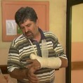 Нападнут радник електродистрибуције