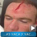 Спорт уживо: Рунијева повреда из хорор филма