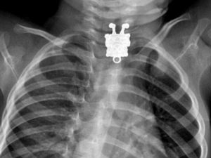 Прогутао Сунђер Боба?!