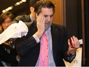 Сеул, рањен амерички амбасадор