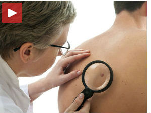 Бесплатни преглeди за рано откривање рака коже