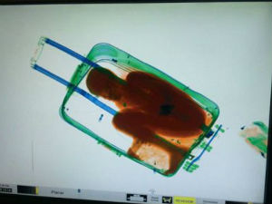 Скенер открио дечака у коферу