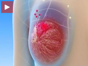 Редовни прегледи повећавају шансу за излечење од рака